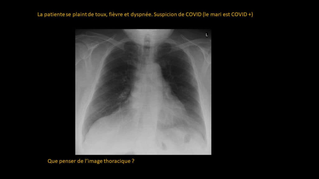 Clinical-Radiological Presentation 05