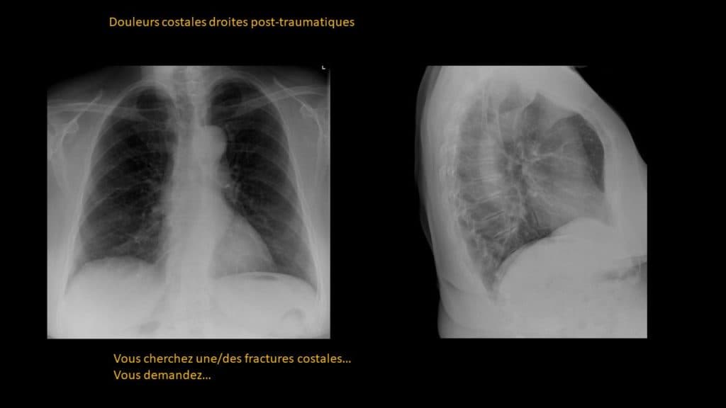 Clinical-Radiological Presentation 06