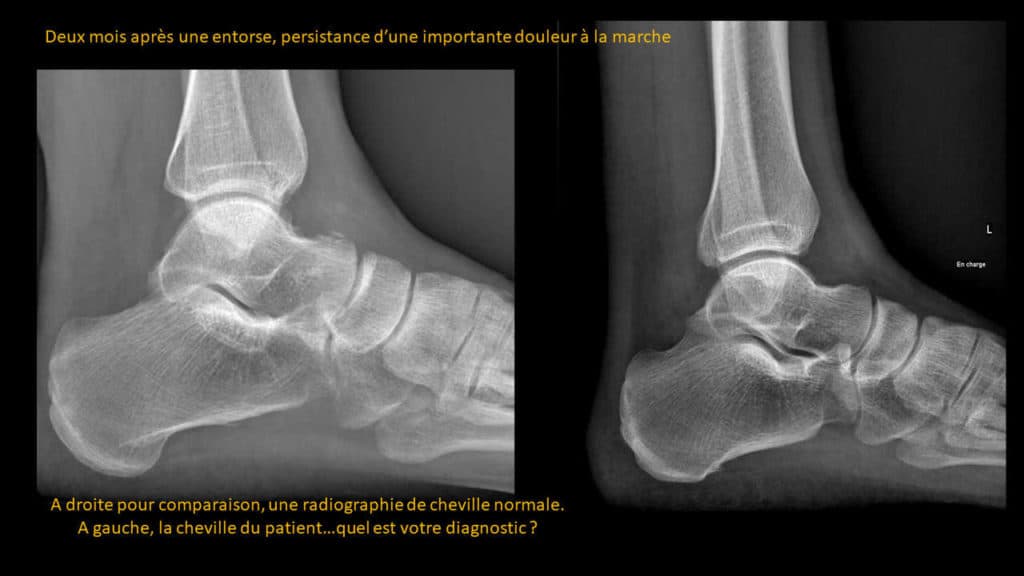 Clinical-Radiological Presentation 01