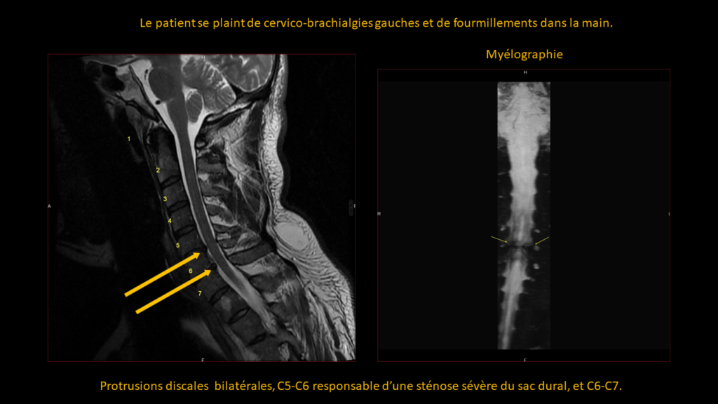 Resposta cervical