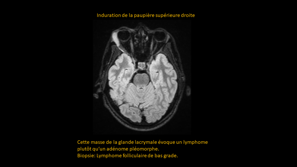 Resposta cérebro