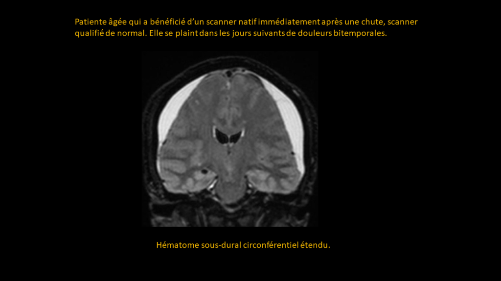Resposta HSD