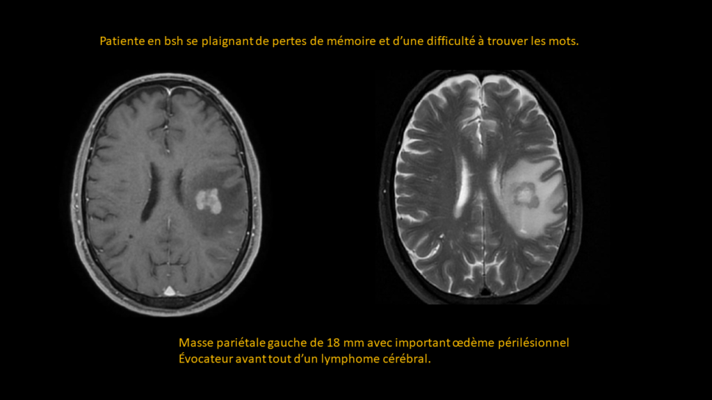 Resposta edema